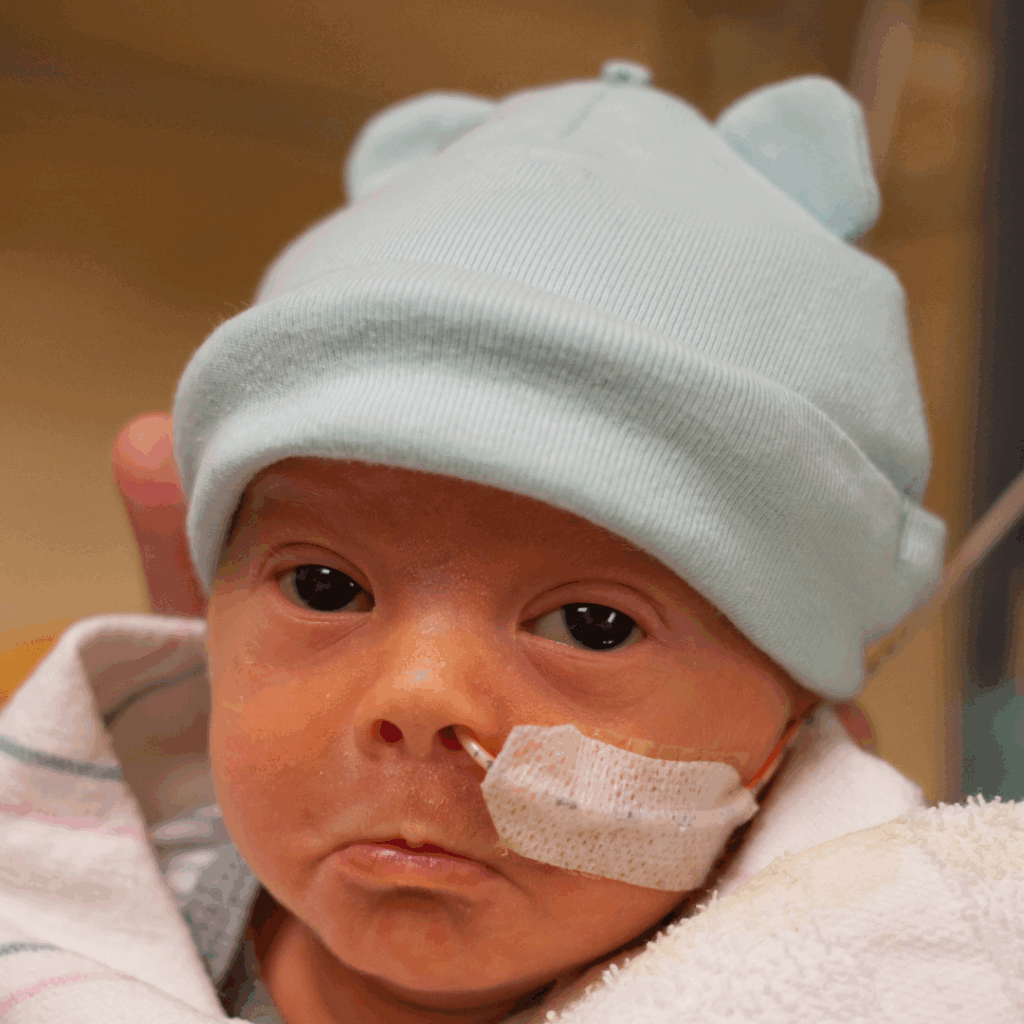 prématurité et peau à peau